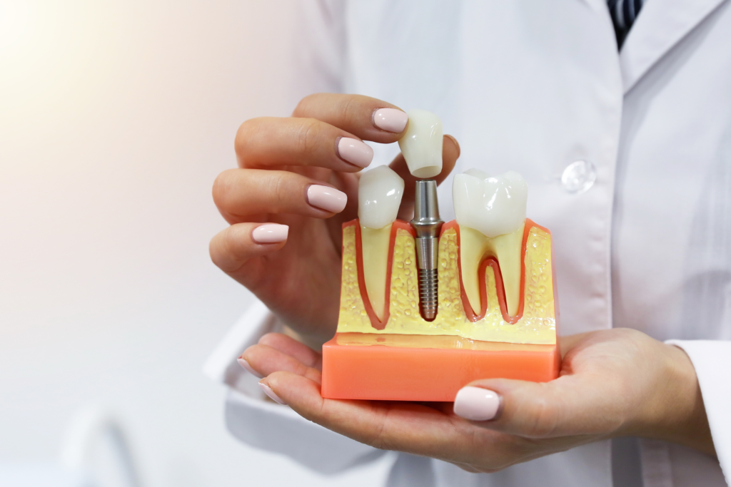 Dental Implant Surgery: Restore Your Smile and Confidence