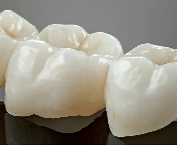 Dental Crown