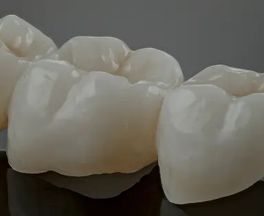 Dental Crown