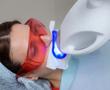 Teeth Whitening