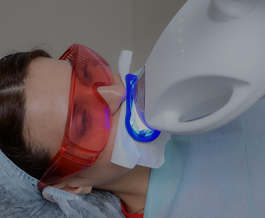 Teeth Whitening