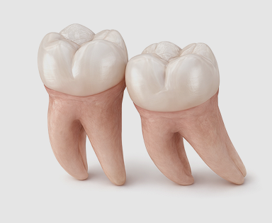 Wisdom Teeth