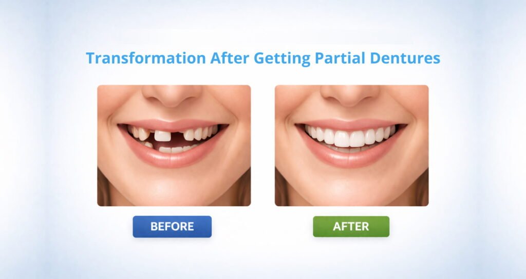 Before and after partial dentures
