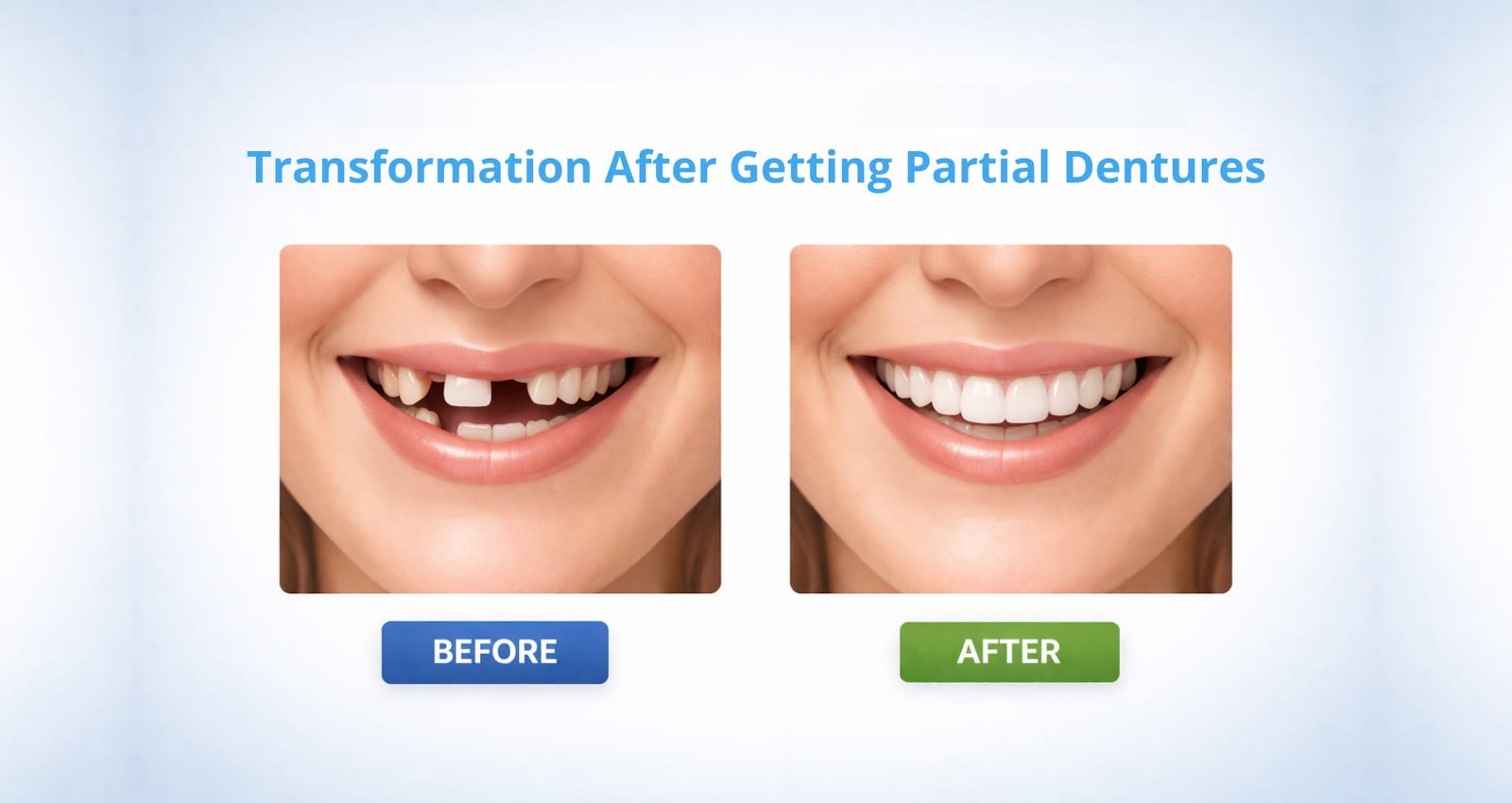 Before and after partial dentures