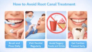 How to Avoid Root Canal Treatment