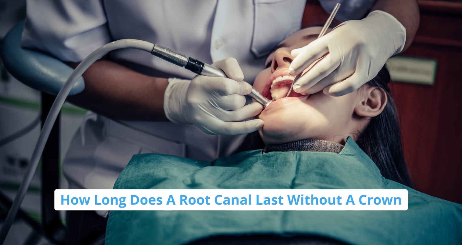 Root-canal