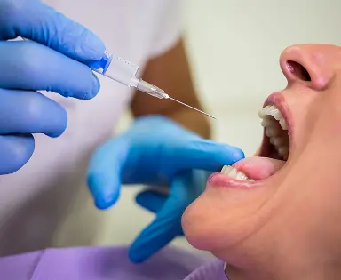 Connective Tissue Graft