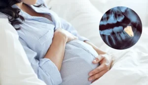 Are Dental X-Rays Safe During Pregnancy