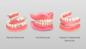 Types of Dentures