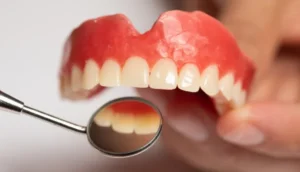 What Makes Dentures Look Natural